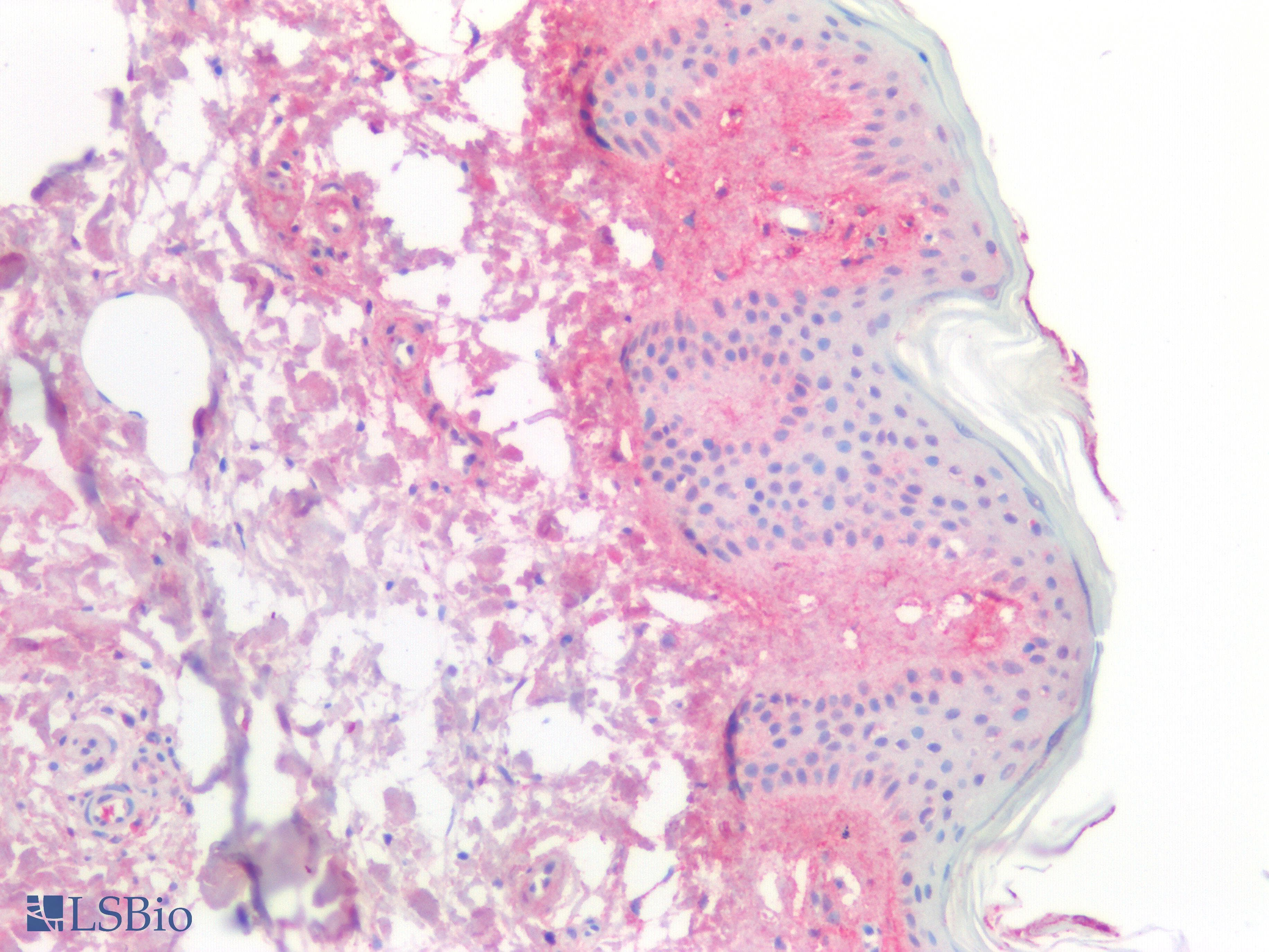 Polyclonal Rabbit anti-Human Procollagen I N-Terminal Propeptide Antibody (aa23-161, IHC, WB)