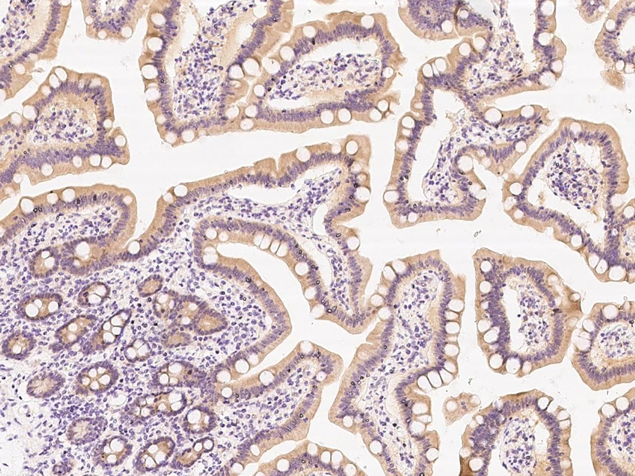 PIK3R2 / p85 Beta Antibody (Preservative Free)