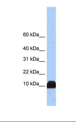 PFN1 / Profilin 1 Antibody (N-Terminus)