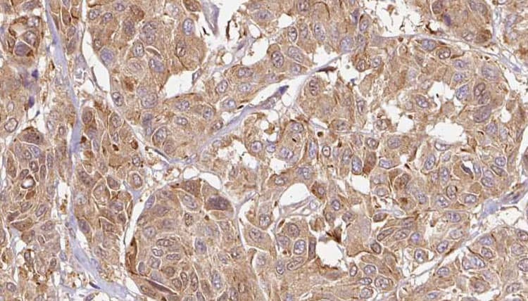 Polyclonal Rabbit anti-Human Endothelin 3 / EDN3 Antibody (IHC, WB)