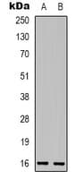 Polyclonal Rabbit anti-Human p16INK4a / CDKN2A Antibody (C-Terminus, WB)