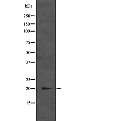 CENPM Antibody