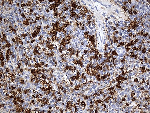 JUP/CTNNG/Junction Plakoglobin Antibody (aa500-745, clone OTI1B4)