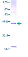 Human VILIP / VSNL1 Protein (Recombinant GST)