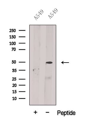 BPIFB2 Antibody