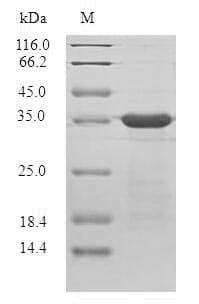 Plasmodium berghei Plasmodium falciparum Protein (Recombinant 6His-SUMO, N-terminus)
