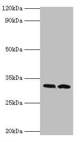 Polyclonal Rabbit anti-Human RDM1 Antibody (aa125-284, IHC, WB)