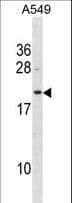 GHBP / BLVRB Antibody (aa119-146)