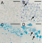 Rhinovirus Antibody (clone R16-7)