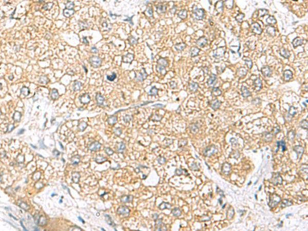 SH3GL2 Antibody