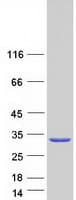 Human SNAP25 Protein (Recombinant Myc-DDK (Flag))