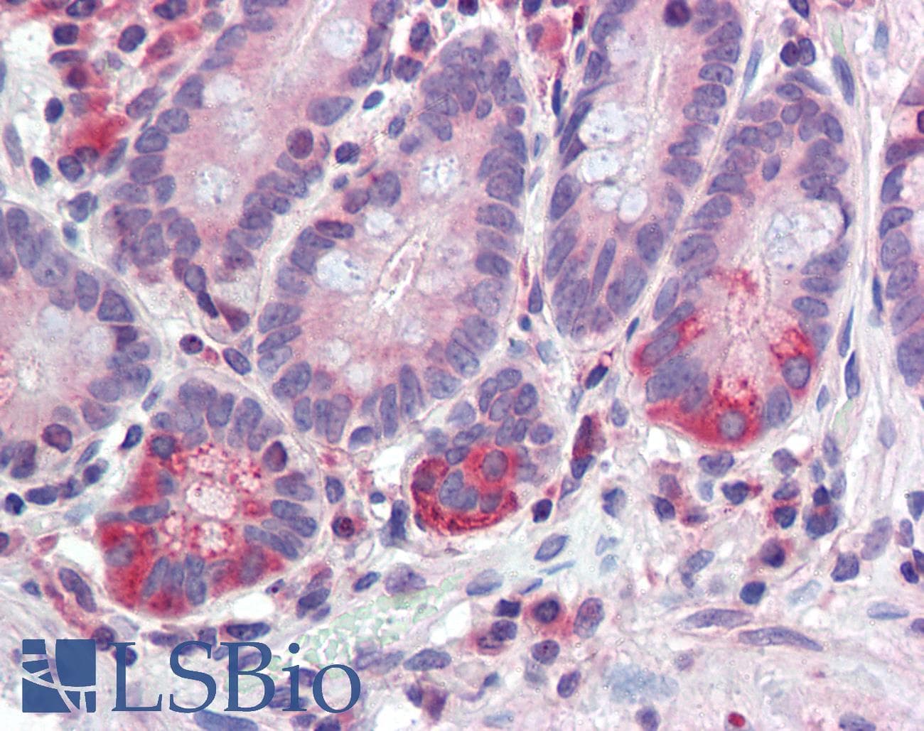 IHC-plus™ TDP1 Antibody (clone AT1F2)