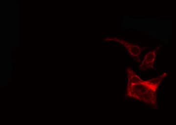 TGFA / TGF Alpha Antibody