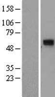 CCDC86 Protein (Over-Expression Lysate Myc-DDK (Flag))