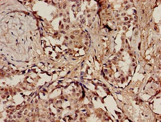 Polyclonal Rabbit anti-Human POLE / POLE1 Antibody (IHC, IF)