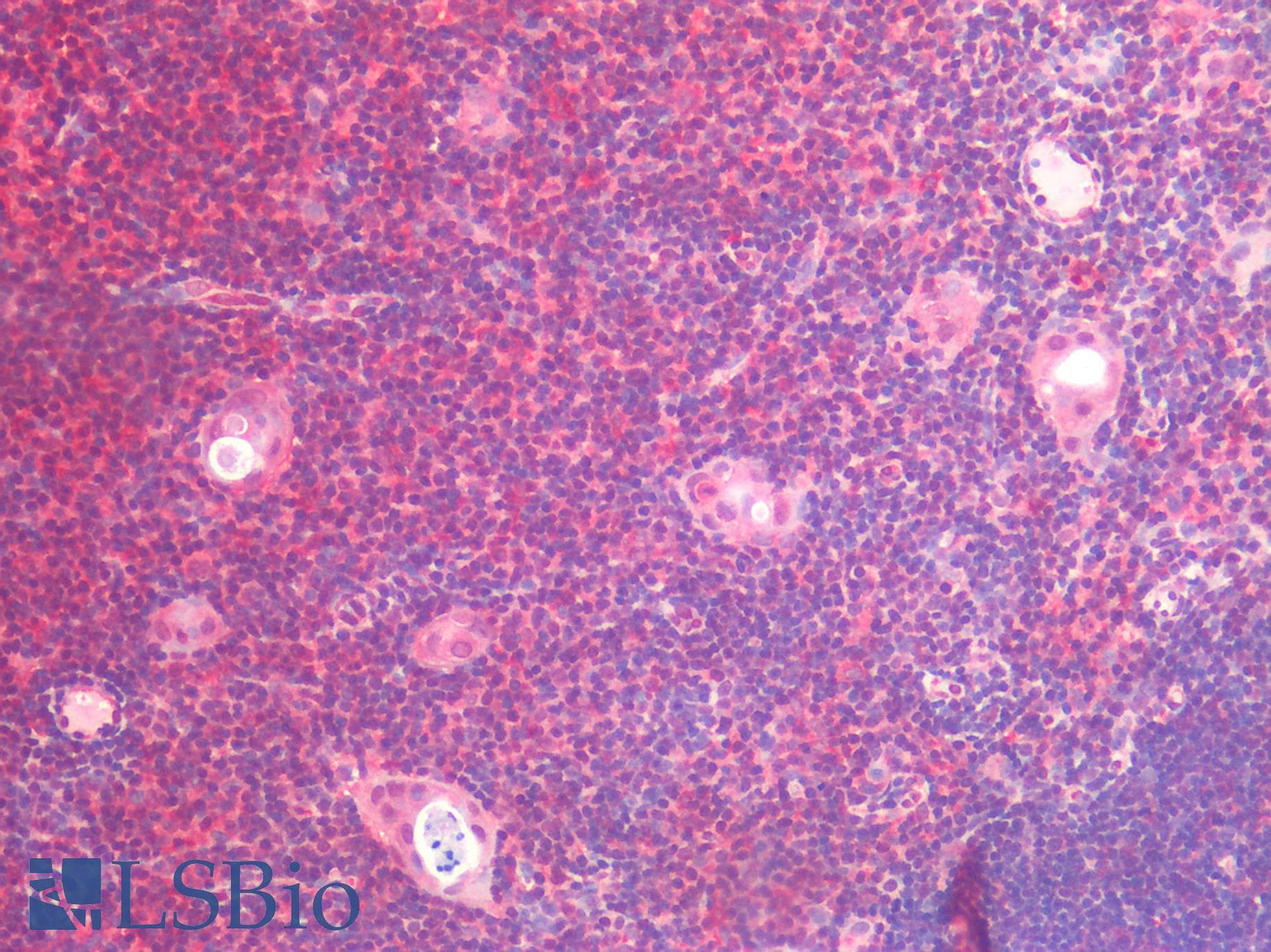 IHC-plus™ IL6 / Interleukin 6 Antibody