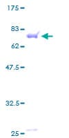 Human DNAJA1 / HDJ2 Protein (Recombinant GST)