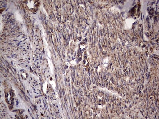 DOCK8 Antibody (aa832-1160, clone OTI4H10)