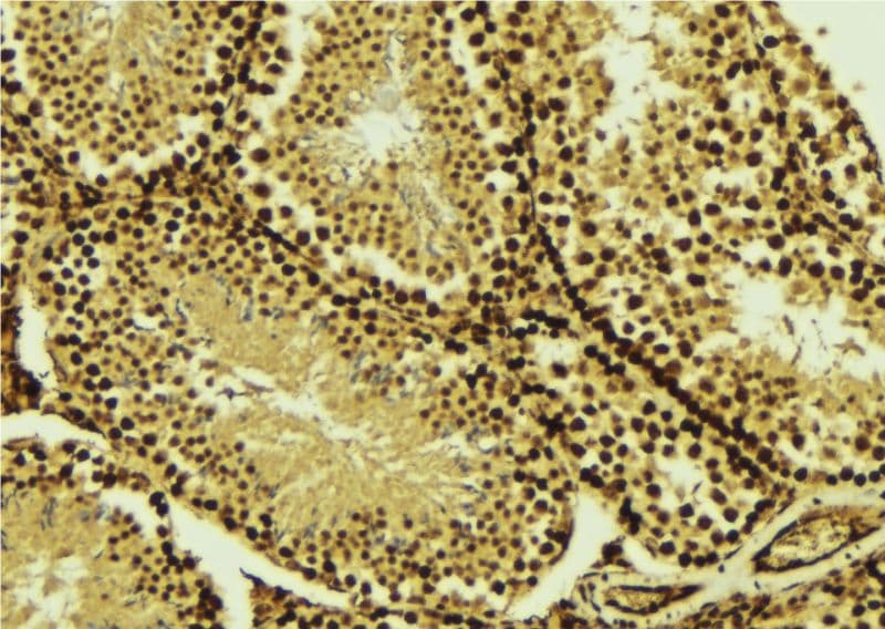 TBP / GTF2D Antibody