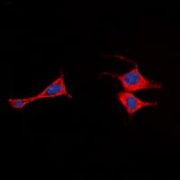 Polyclonal Rabbit anti-Human ADGRE2 / EMR2 Antibody (Internal, IF, WB)