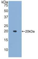 Human IL1F9 Protein (Recombinant His, N-Terminal)