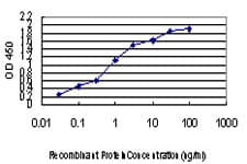 Monoclonal Mouse anti-Human SEPHS2 Antibody (clone 2G9, IHC, WB)