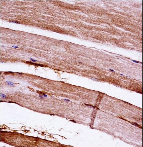 MAPKAPK3 Antibody (aa63-90)