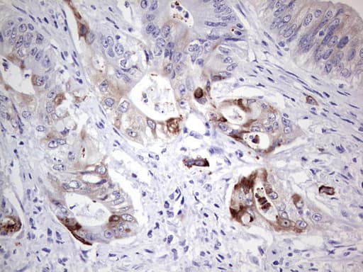LAMB3 / Laminin Beta 3 Antibody (aa424-773, clone OTI2D11)