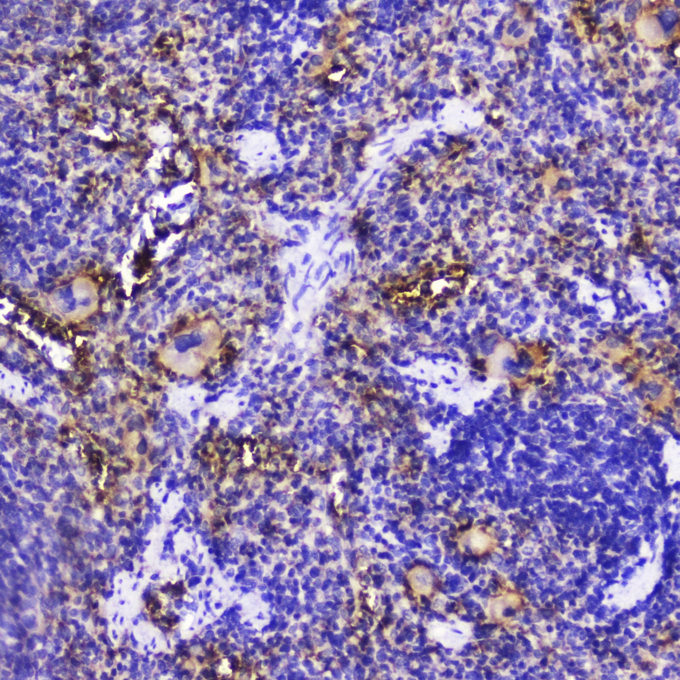 TLN1 / Talin 1 Antibody