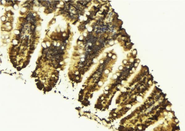 ITGB3BP Antibody