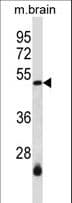 SMARCB1 / INI1 Antibody (aa52-81)