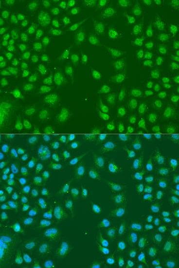 Polyclonal Rabbit anti-Human HNRNPCL1 Antibody (IF)