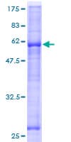 Human ASB17 Protein (Recombinant GST)