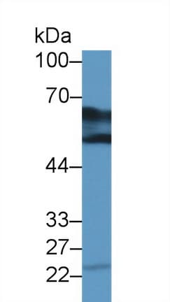DDC / DOPA Decarboxylase Antibody (aa200-420)