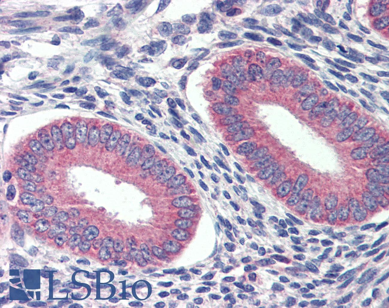 GRHL2 Antibody (C-Terminus)