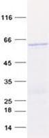 Human Tpsb2 / Tryptase Beta 2 (Mouse Protein (Recombinant GST, N-terminus + His, C-terminus)