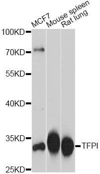 Polyclonal Rabbit anti-Human TFPI / LACI Antibody (WB)