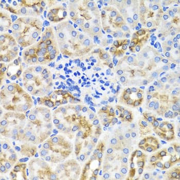 PRKAG1 / AMPK Gamma 1 Antibody