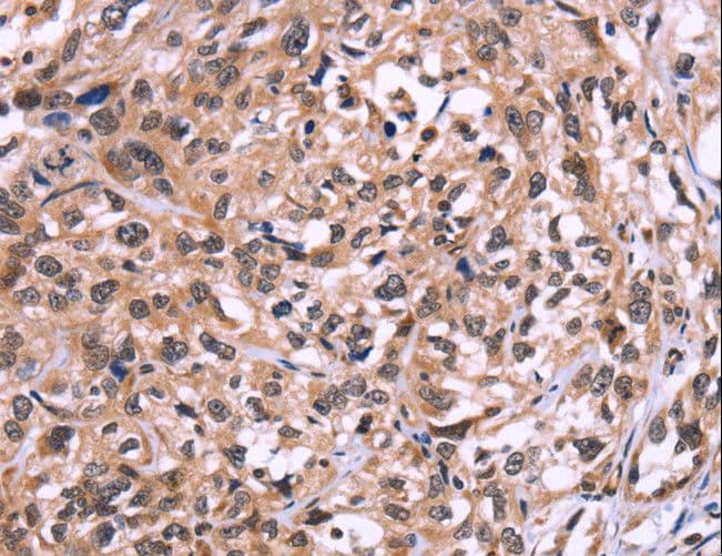 Polyclonal Rabbit anti-Human AMIGO2 Antibody (IHC, WB)