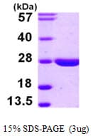 Human LYPLA2 Protein (Recombinant His)