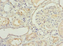 NNMT Antibody