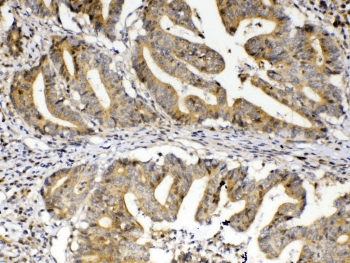 FZD3 / Frizzled 3 Antibody