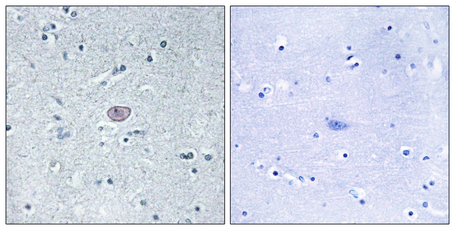 KDR / VEGFR2 / FLK1 Antibody (aa917-966)