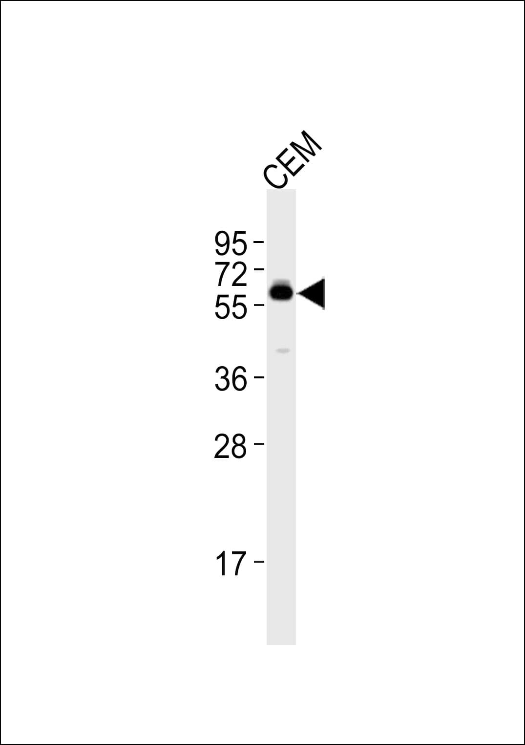 CSRNP2 / FAM130A1 Antibody