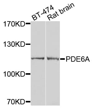 Polyclonal Rabbit anti-Human PDE6A / PDE6 Alpha Antibody (WB)