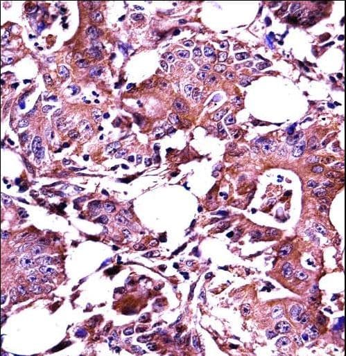 LGALS3 / Galectin 3 Antibody (aa167-196)
