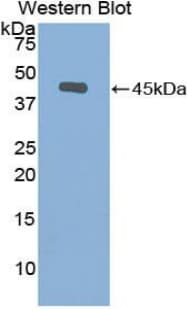 GSN / Gelsolin Antibody (aa432-553)