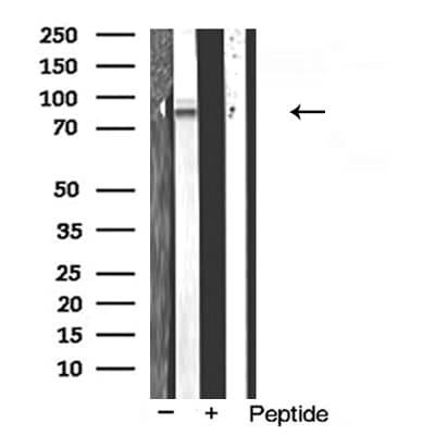 IHC-plus™ ADAM10 Antibody