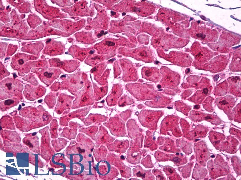 IHC-plus™ Monoclonal Mouse anti-Human PDPN / Podoplanin Antibody (clone 5E2, aa1-206, IHC, WB)