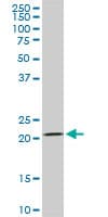 DHFR Antibody (clone 2B10)